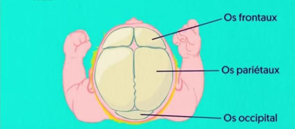 Comment éviter le syndrome de la tête plate du bébé plagiocéphalie