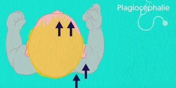 COMMENT EVITER LE SYNDROME DE LA TETE PLATE DU BEBE